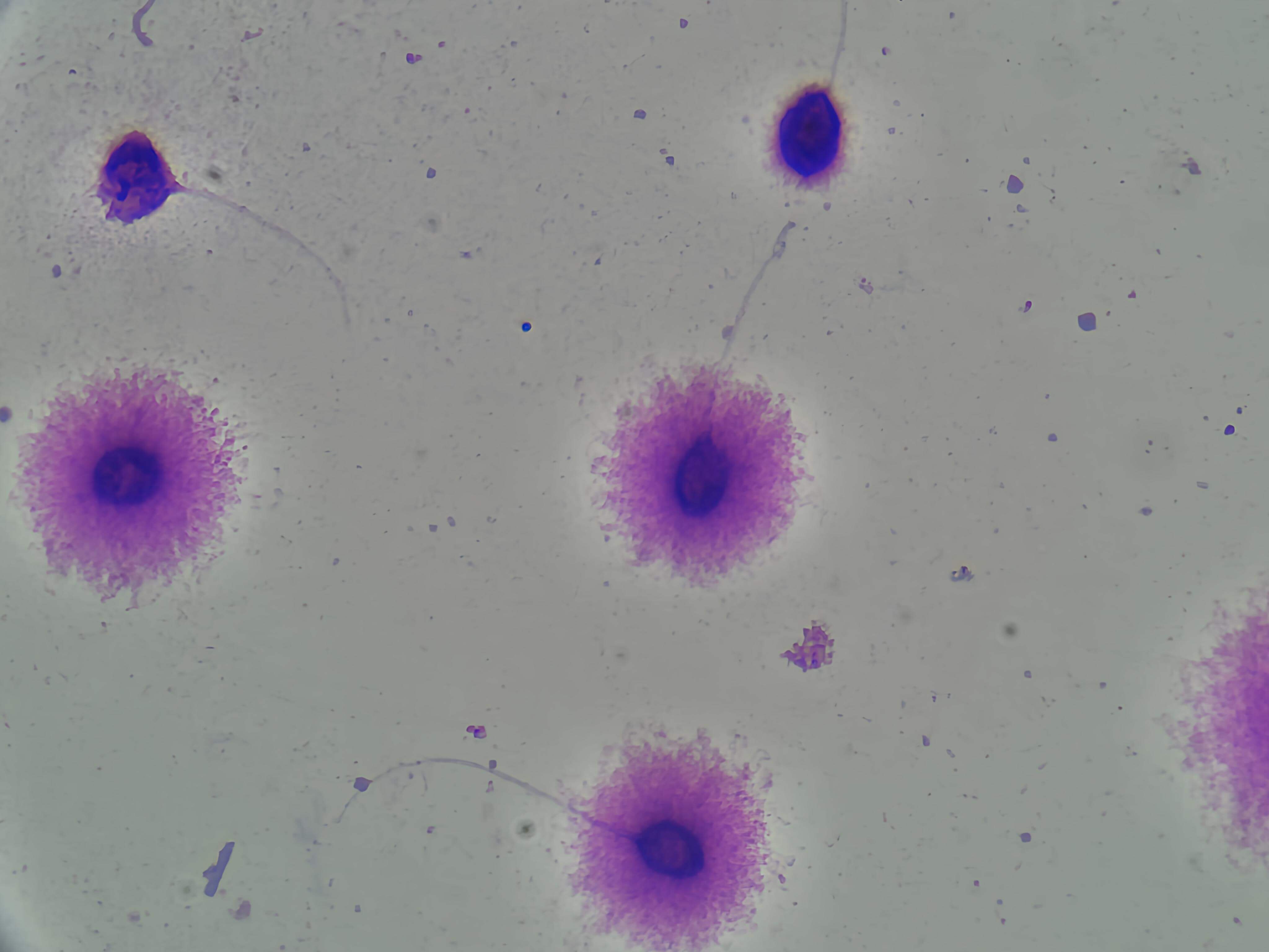 Sperm DNA Fragmentation SCD assay kit for laboratory testing